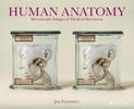 Human Anatomy: Stereoscopic Images of Medical Specimens